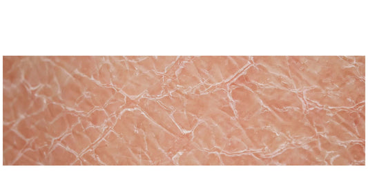 Why Do Menopausal Women Get Vaginal Dryness?