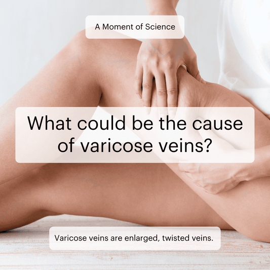 Varicose veins: Causes and solutions